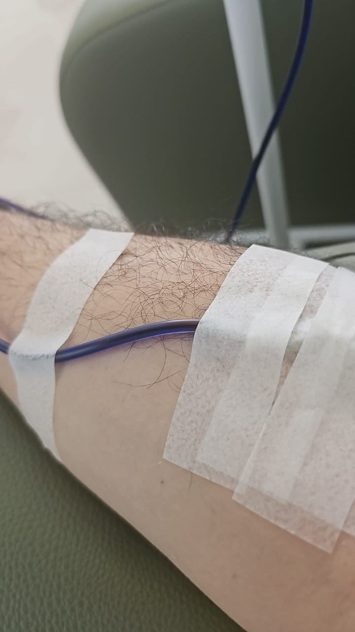 Acesso venoso fixado com fita no antebraço.